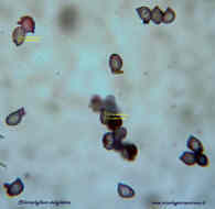 spore Chlorophyllum molybdites