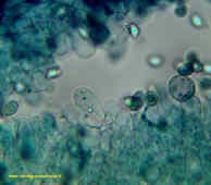 Microscopia spore Macrolepiota Chlorophyllum rachodes
