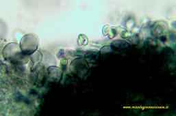 Microscopia Macrolepiota Chlorophyllum rachodes