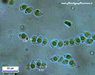 Clavaria fragilis vermicularis spore