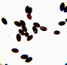 Spore di Coprinopsis lagopus
