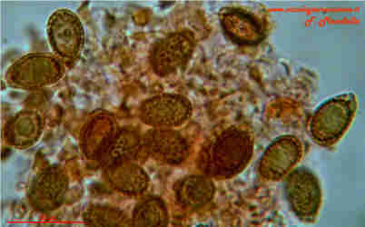 Spore di Ganoderma applanatum