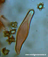 Inocybe asterospora cistidi