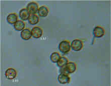 Lycoperdon perlatum spore