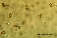 spore Pholiota adiposa