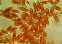 Sarcoscypha austriaca spore