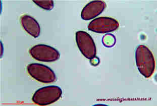 microscopia Stropharia semiglobata