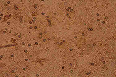 Amylosporus campbellii spore